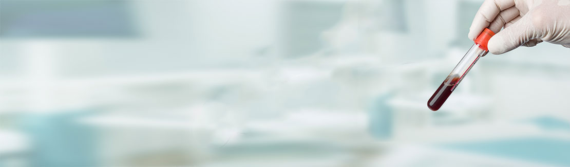 Corona Antikörpertest